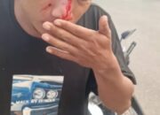 Pohon Tumbang di Jalan Tuanku Tambusai Rohul, Dua Pengendara Luka-luka